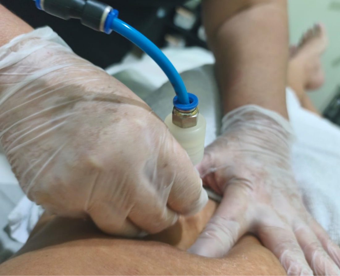 Tratamento de Estrias sinop, utilizando técnicas manuais e equipamentos estéticos especializados, Esse serviço profisisonal você só encontra na Belle - Cabelo e Estética em Sinop-MT, o melhor preço com uma qualidade excepcional, profissionais com mais de 10 anos de experiência.